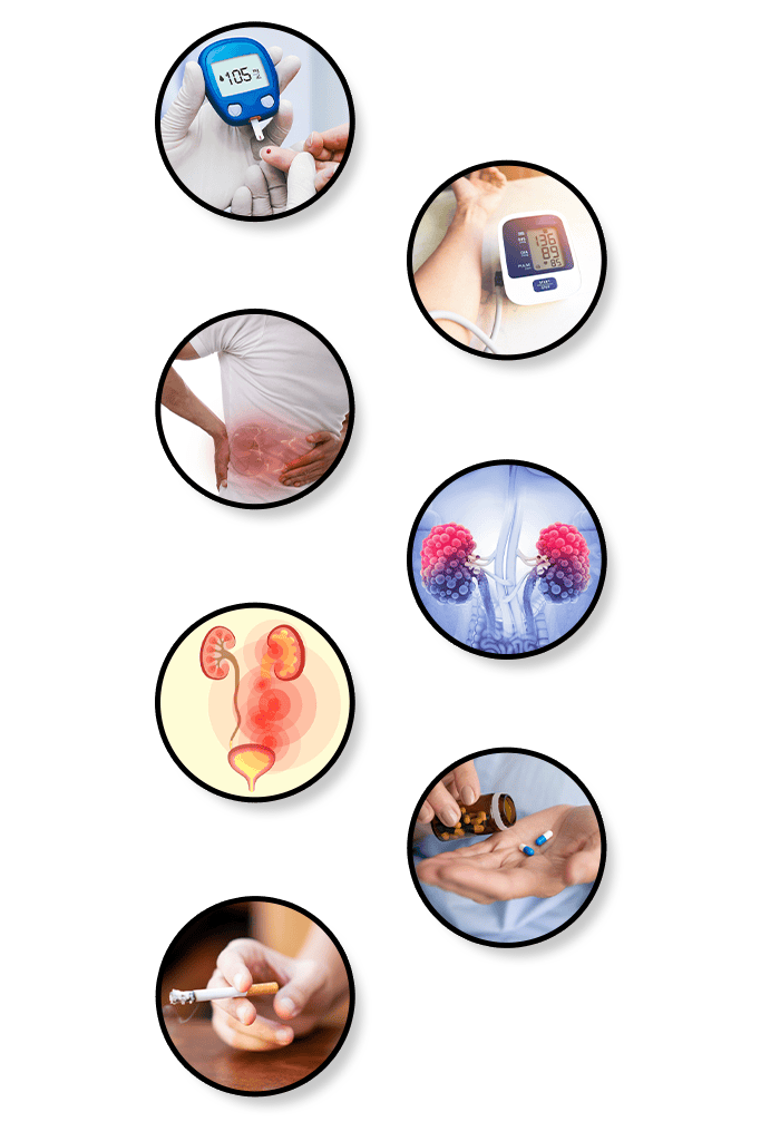 Kidney Diseases can have various causes